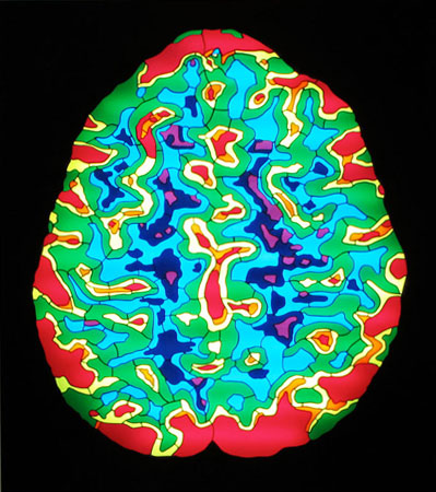 The Meditating Brain, Royal Free Hospital